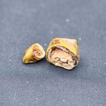 Set of dental gold for refining, gross weight:...