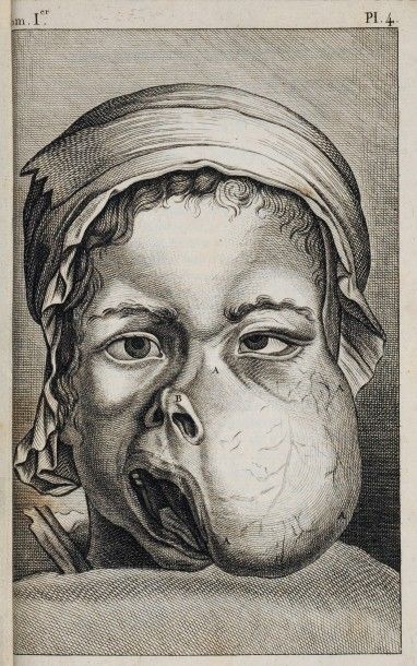 [Chirurgie] [Dentisterie] JOURDAIN (Anselme...