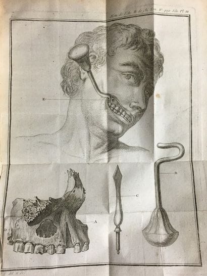 [Chirurgie] Mémoires de l'Académie royale...