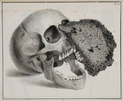[Dentisterie] FOX (Joseph). Histoire naturelle...