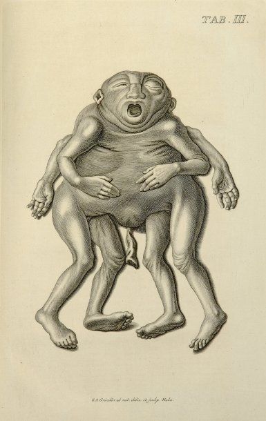 BOEHMER, PHILIP ADOLF
Observationum anatomicarum...