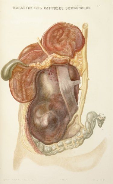 RAYER, PIERRE
Traité des maladies des Reins...