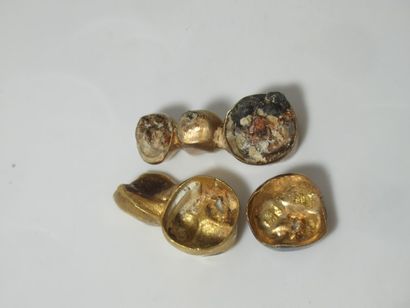 Lot d'or dentaire. Poids brut : 12,5 g