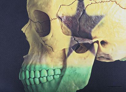MR. STRANGE (20th century)

Skull Ghana

Lithograph...