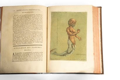 GAUTIER d'AGOTY (Jacques-Fabien). Observations...
