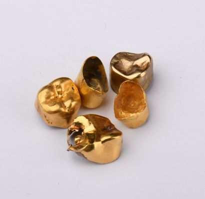 Dental gold.
8.18 grams