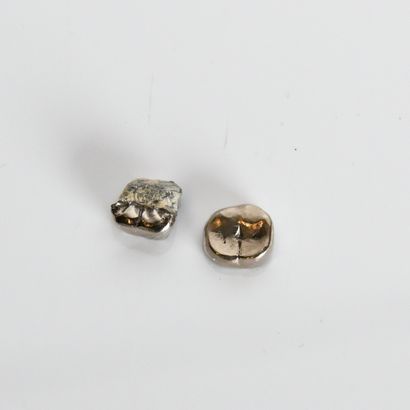 Amalgam-free white gold dental work
4.07...
