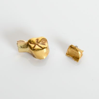 Dental gold in yellow gold without amalgam
5.79...
