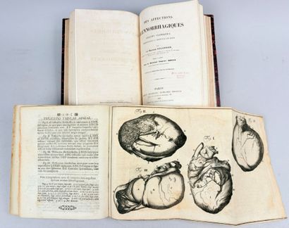 [Médecine] [Recueil sur l'Hydrocèle et le...