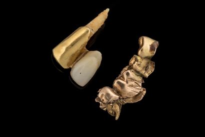 Dents en or avec racines. PB: 10.8 g