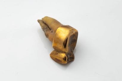 Gold Tooth 
PB: 6 g