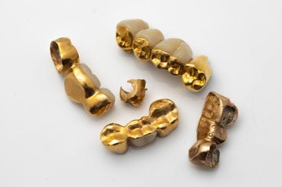 Small set of dental gold with roots 
PB:...