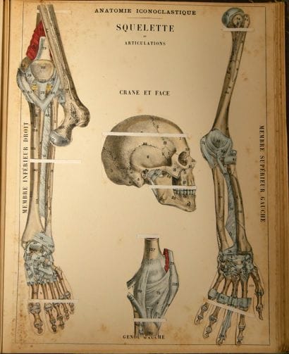 WITKOWSKI (G.-J.). Iconoclastic Anatomy....
