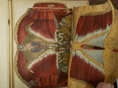 WITKOWSKI (G.-J.). Iconoclastic Anatomy....