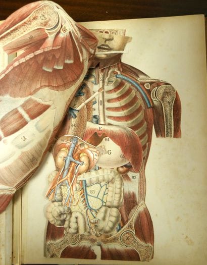 WITKOWSKI (G.-J.). Iconoclastic Anatomy....