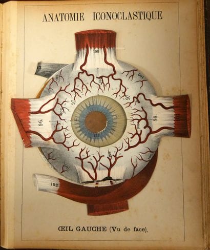 WITKOWSKI (G.-J.). Iconoclastic Anatomy....