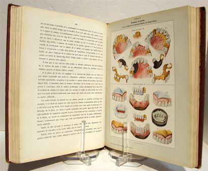 MULLER (Dr. Eugène). Atlas and Treatise on...