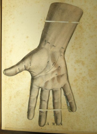 WITKOWSKI (G.-J.). Iconoclastic Anatomy....