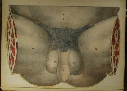 WITKOWSKI (G.-J.). Iconoclastic Anatomy....