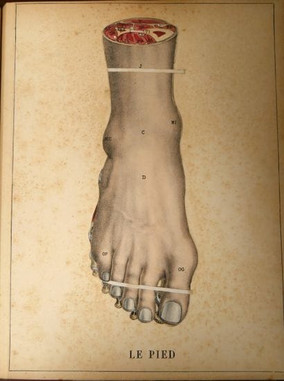 WITKOWSKI (G.-J.). Iconoclastic Anatomy....