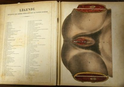 WITKOWSKI (G.-J.). Iconoclastic Anatomy....