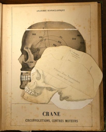 WITKOWSKI (G.-J.). Iconoclastic Anatomy....
