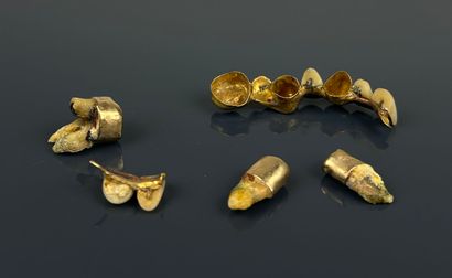 Lot of dental debris in 20k and 18k dental...