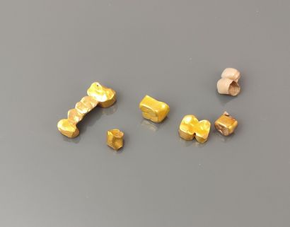 Gold dental debris 
Gross weight: 17.6 g