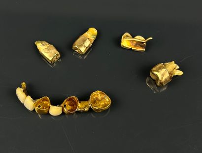 Lot of dental debris in 20k and 18k dental...