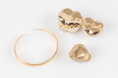 Small lot of gold dental work and gold wedding...