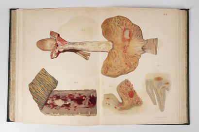 LESSER (Adolphe)
Atlas de médecine légale....