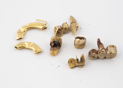 Lot of gold fragments (750) including dental...