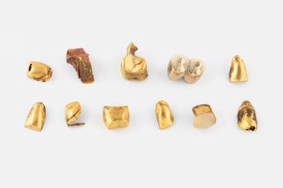 Lot in yellow gold (750) with pieces of dental...