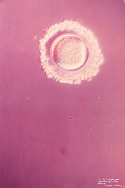 Lennart NILSSON (1922-2017)
Ovum (scientific...