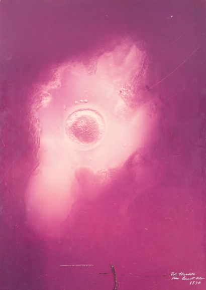 Lennart NILSSON (1922-2017)
Ovum (scientific...