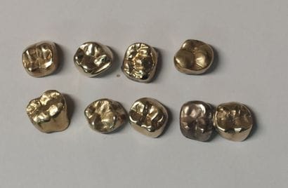 DENTAL GOLD

PB : 22,2 g