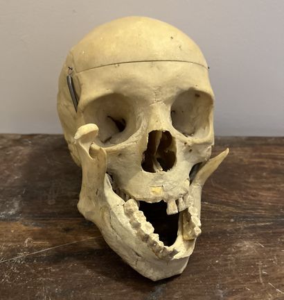 Replica of a study skull, the cap held by...