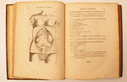 Médecine - MAURICEAU (François). Traité des...